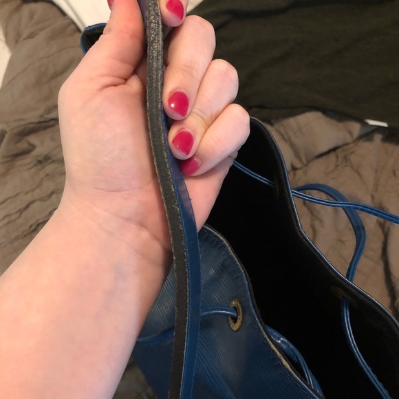 Additional photos of LV epi noe - Picture 3 of 8